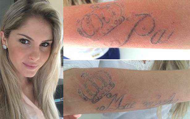 mulher mostrando o braço com a tatuagem desbotada sabendo dos riscos da anestesia na tatuagem